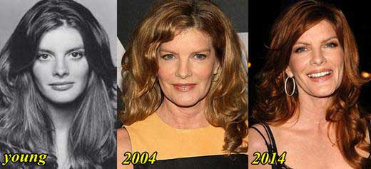 Rene-Russo-Plastic-Surgery-Before-and-After