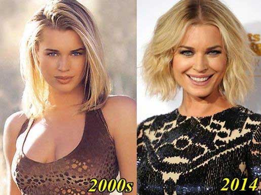 Rebecca-Romijn-before-and-after-plastic-surgery